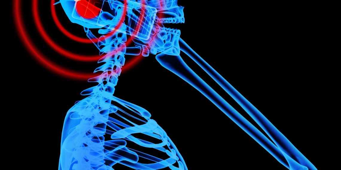 Studi: Radiasi Ponsel Ganggu Kinerja Otak bahkan Picu Kanker