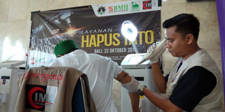 Puluhan Masyarakat Ikuti Program Hapus Tato  Era Madani