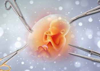 Aborsi